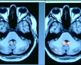 地平线系列：记忆的实现